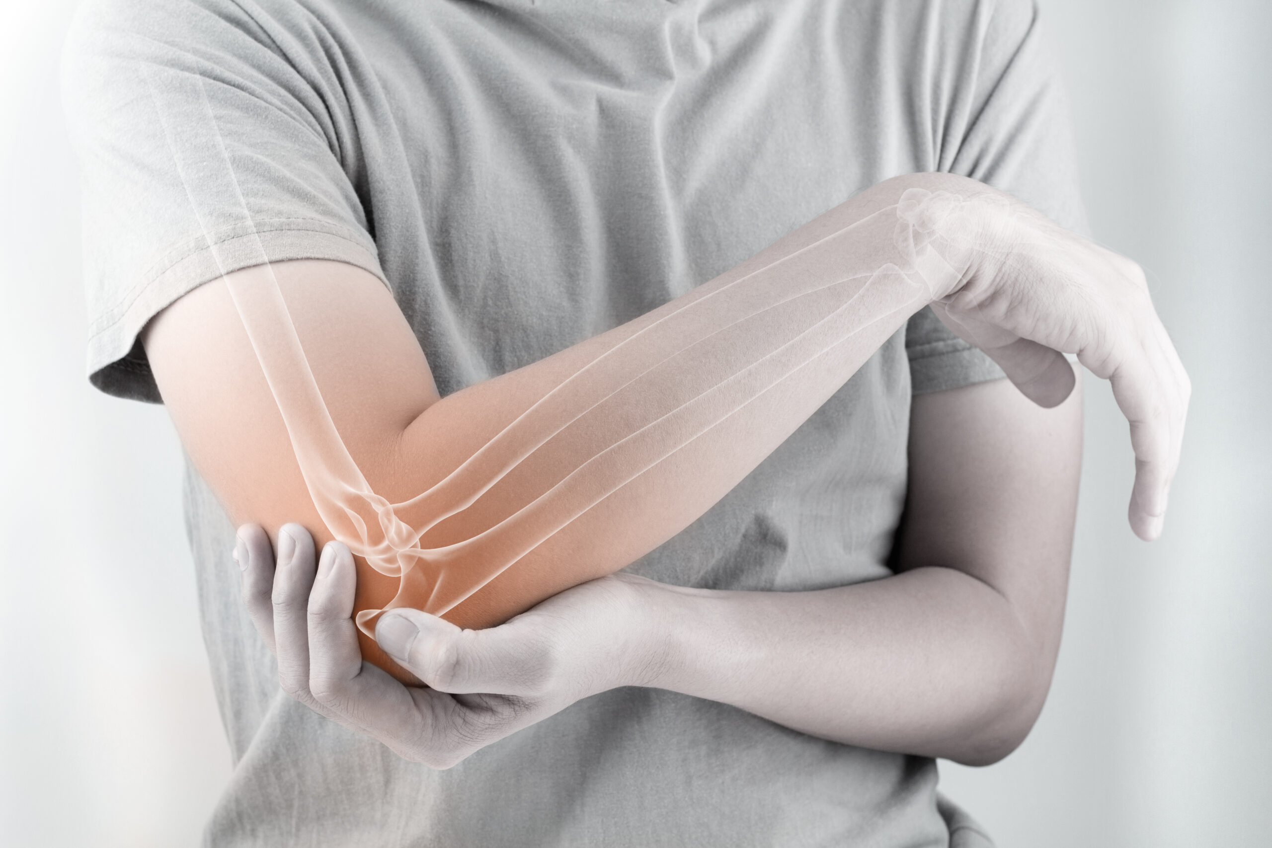 Holding elbow with bone pain