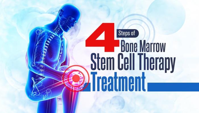 4 steps of bone marrow stem cell therapy treatment