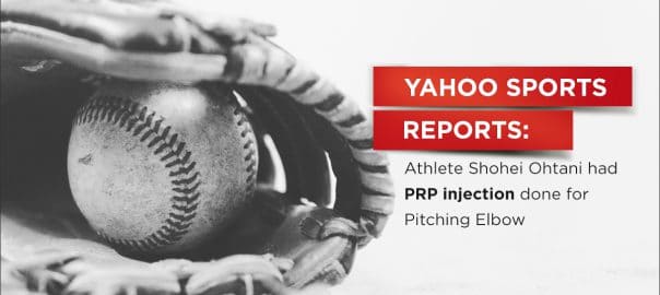 yahoo sports reports that shohei ohtani pitcher for the angels had a prp injection in pitching elbow 5fefc651a8358