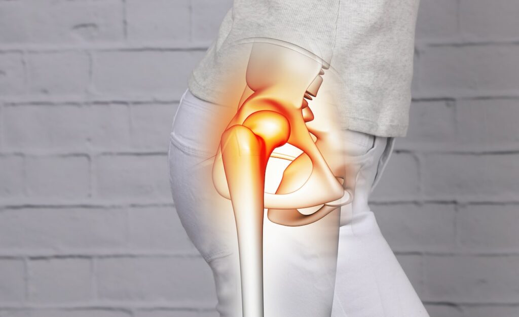 prp for hip osteoarthritis