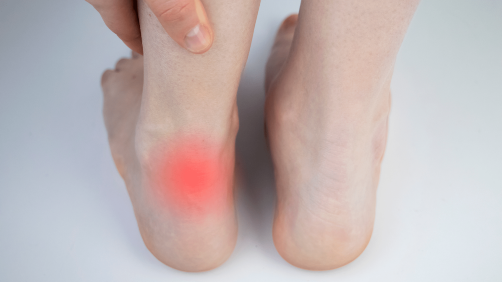 shockwave therapy for achilles tendonitis